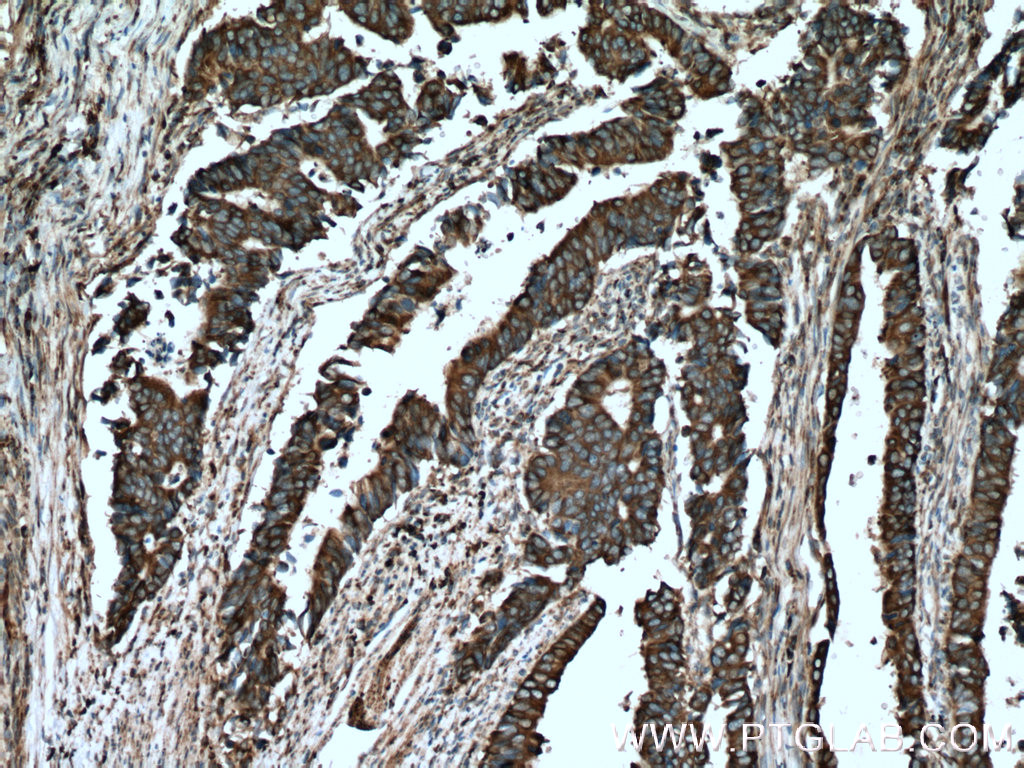C8orf48 Polyclonal antibody