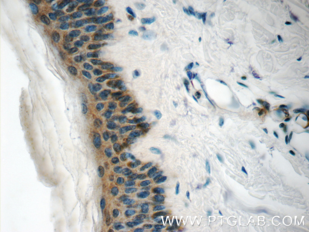 C21orf58 Polyclonal antibody