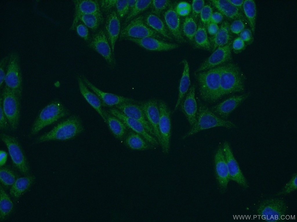 NWD1 Polyclonal antibody