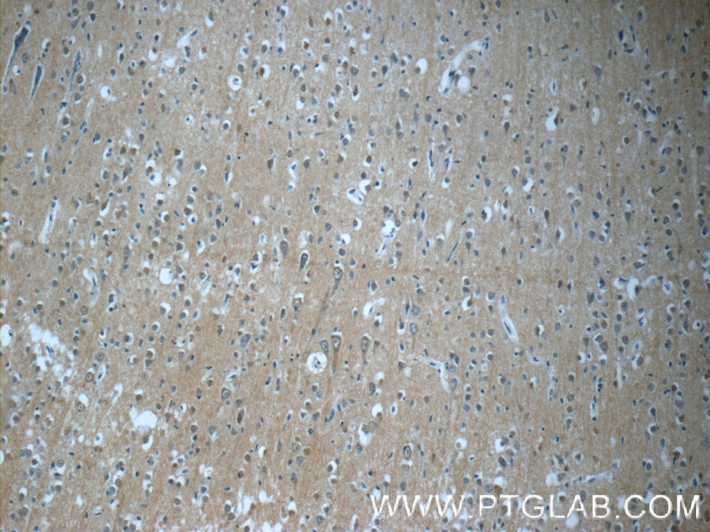 TPPP Polyclonal antibody