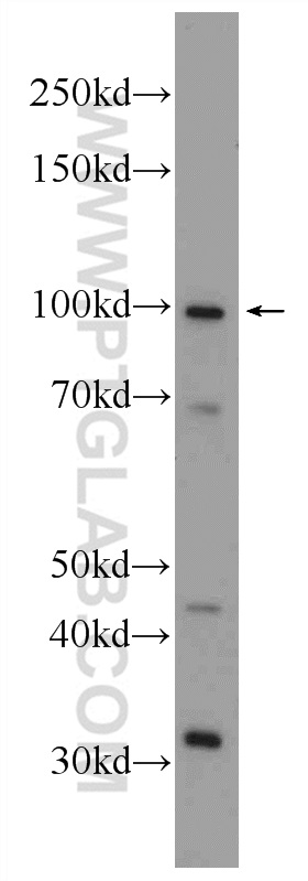 CCDC40 Polyclonal antibody