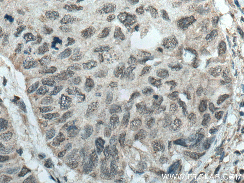 NR1H4 Polyclonal antibody