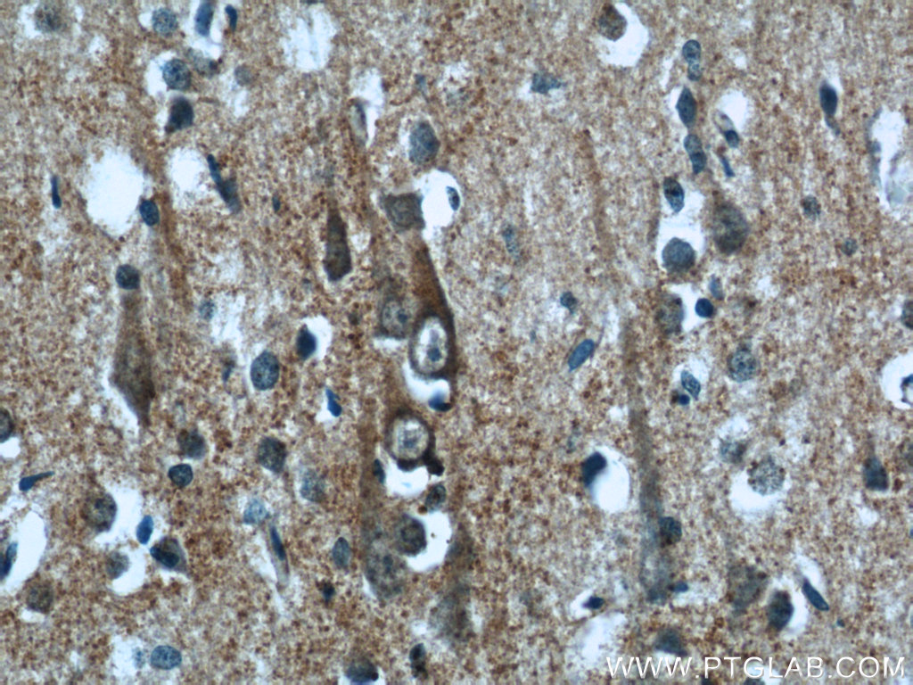 KLHL15 Polyclonal antibody