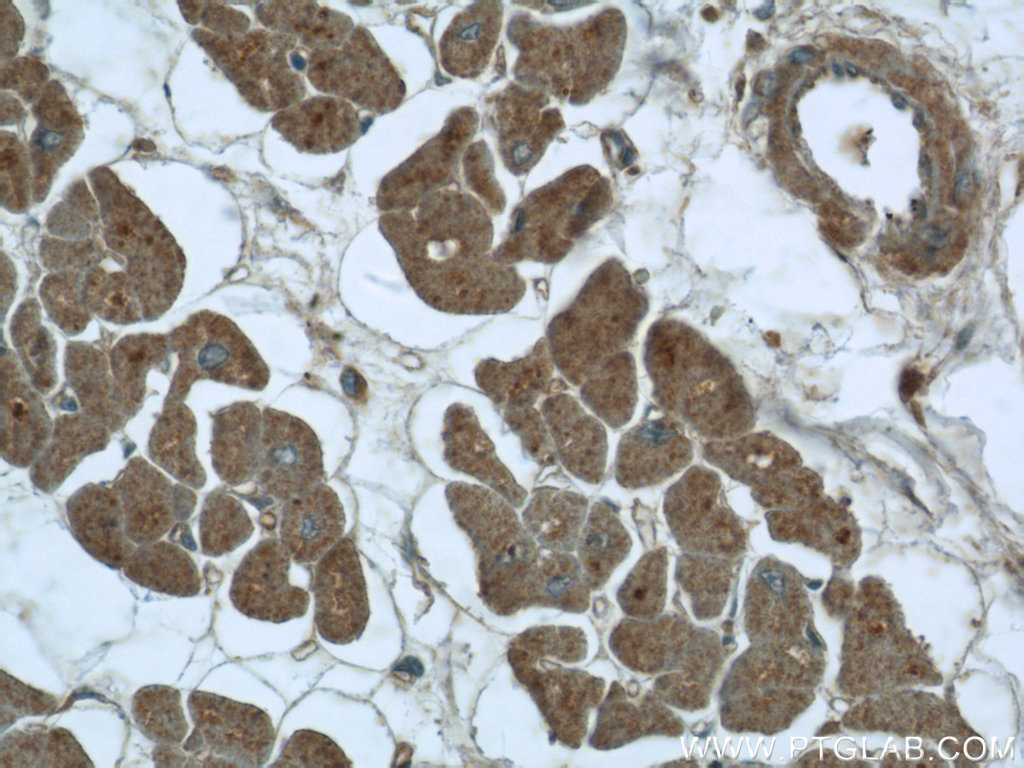 RIG-1/DDX58 Polyclonal antibody
