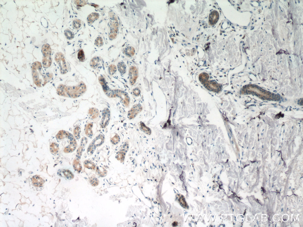 TGM5 Polyclonal antibody