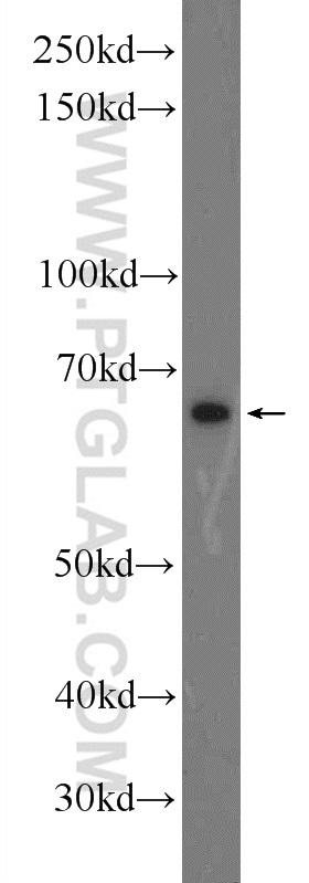 TTC26 Polyclonal antibody
