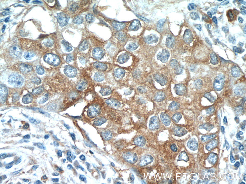 TMEM87A Polyclonal antibody