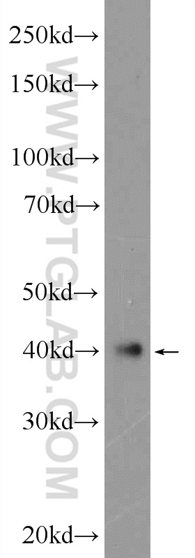 ATXN3L Polyclonal antibody