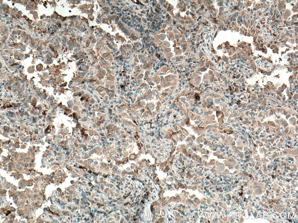 WFDC12 Polyclonal antibody