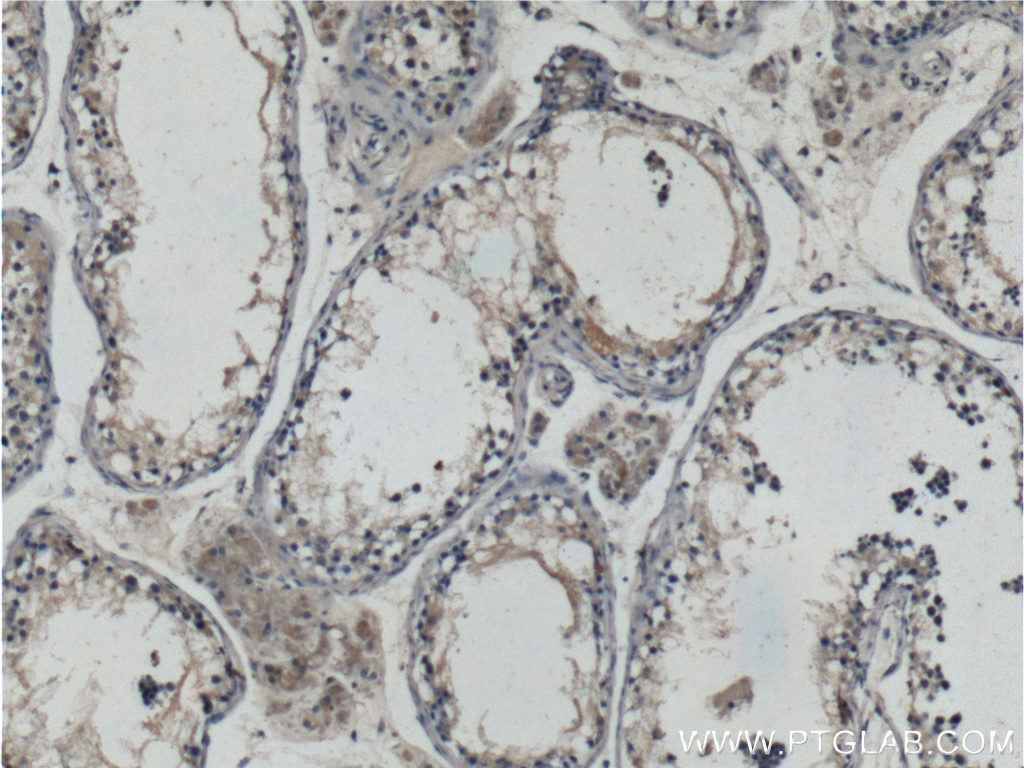HIPK3 Polyclonal antibody