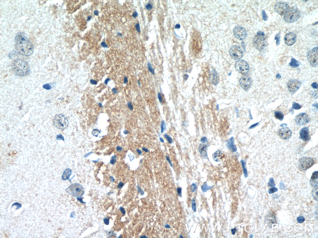 NYAP2 Polyclonal antibody