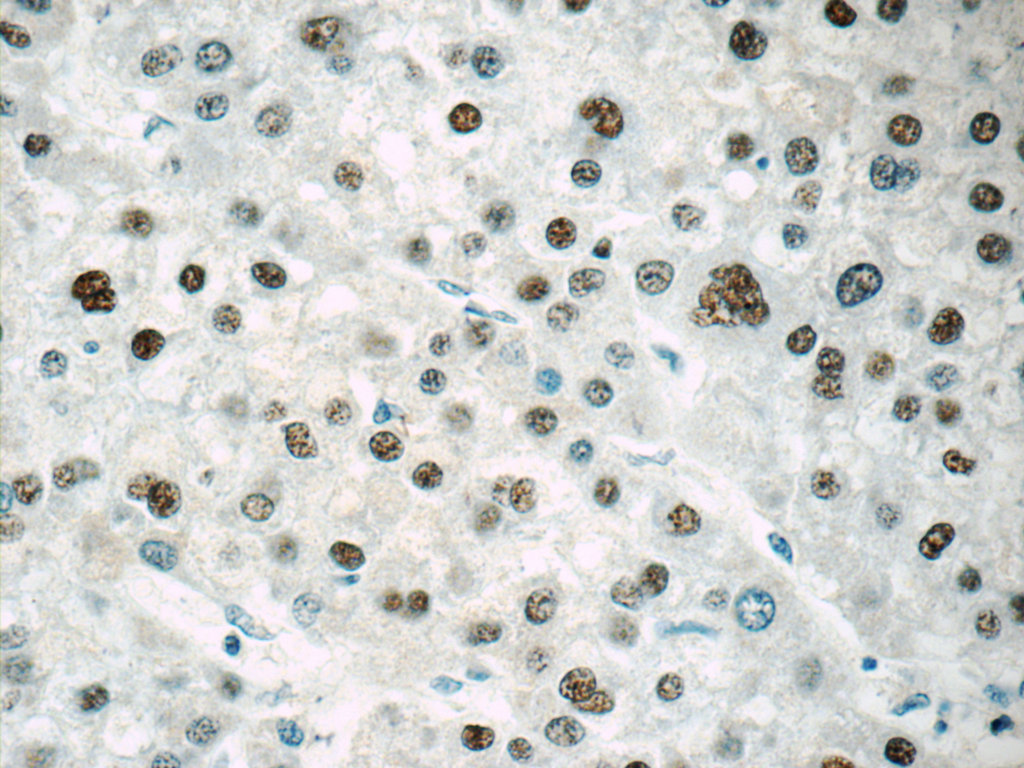 ONECUT1 Polyclonal antibody