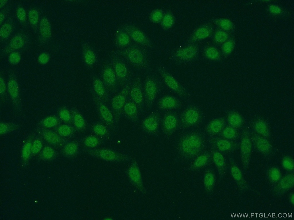 HNRNPA3 Polyclonal antibody