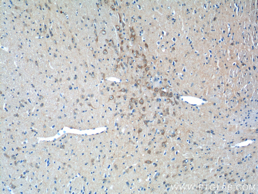 LIN7A Polyclonal antibody
