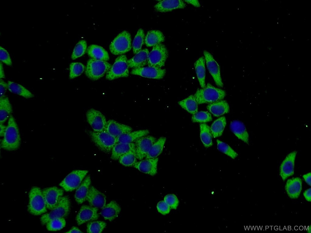 PROSC Polyclonal antibody
