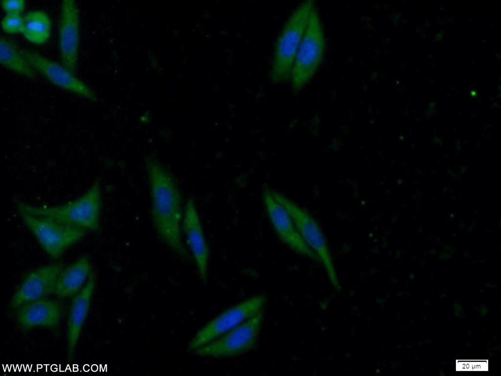 ATG2B Polyclonal antibody