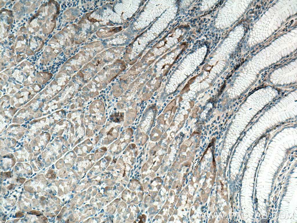 EFCAB2 Polyclonal antibody