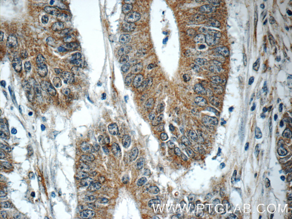 TMEM156 Polyclonal antibody