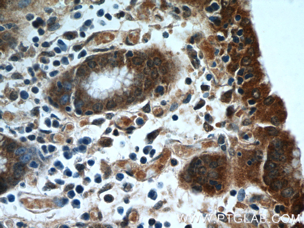 HIVEP1 Polyclonal antibody