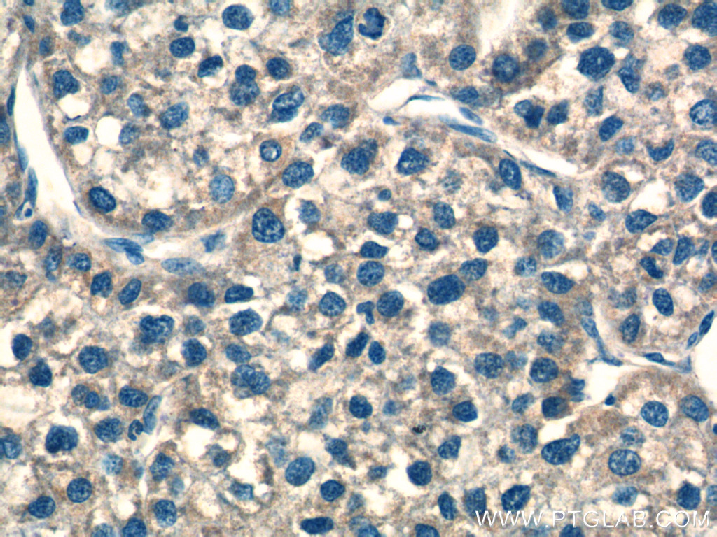 NDUFS8 Polyclonal antibody