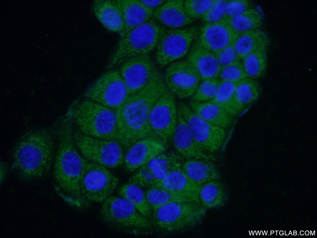 SAMD9L Polyclonal antibody