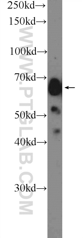 Glypican 3 Polyclonal antibody