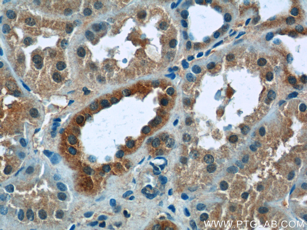 ZNF497 Polyclonal antibody
