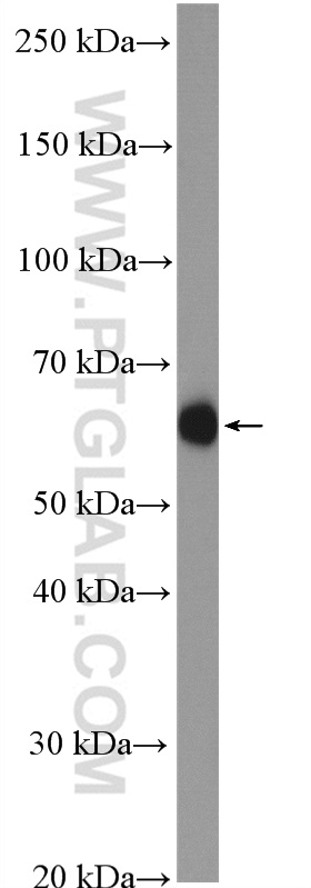 HYAL1 Polyclonal antibody