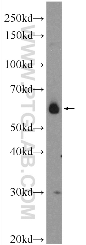 CDC14B Polyclonal antibody