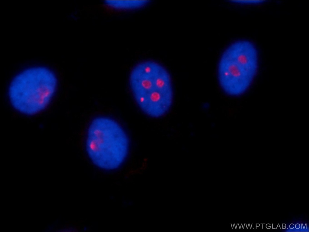 RSL24D1 Polyclonal antibody
