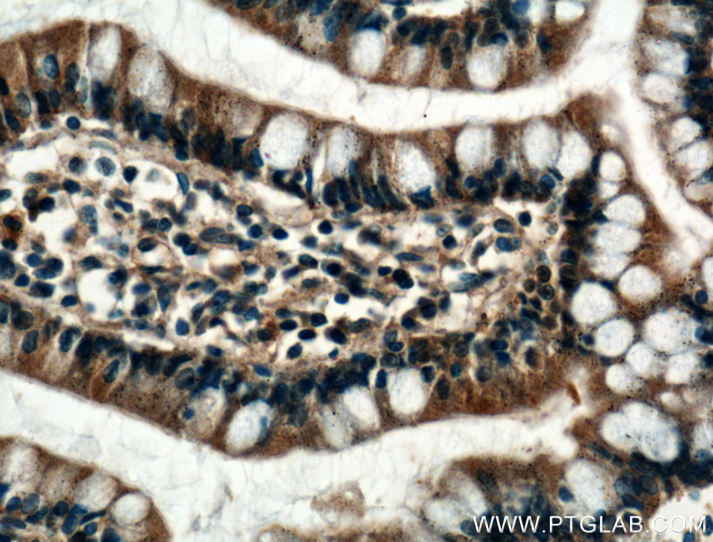 FBP2 Polyclonal antibody