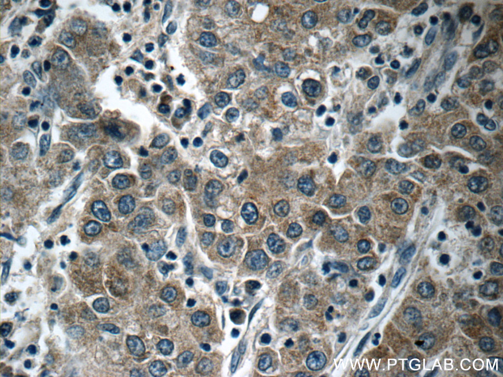 KIAA0125 Polyclonal antibody