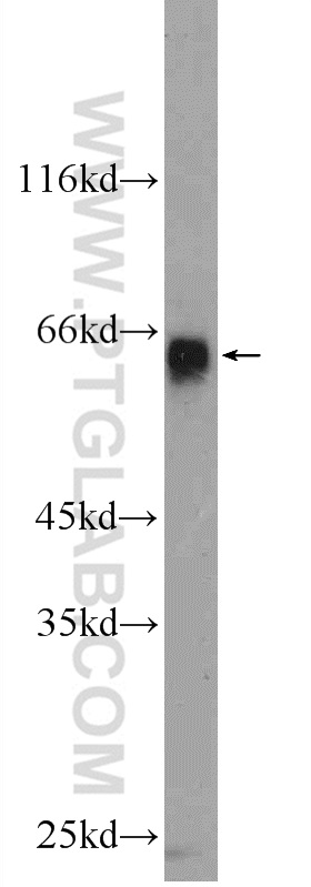 ZIM3 Polyclonal antibody