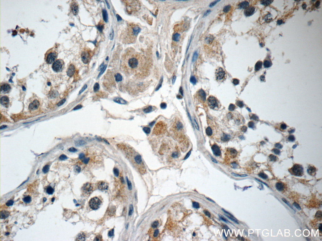 ANKRD33 Polyclonal antibody