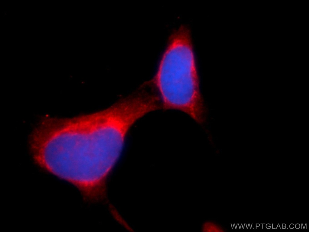 DDHD2 Polyclonal antibody