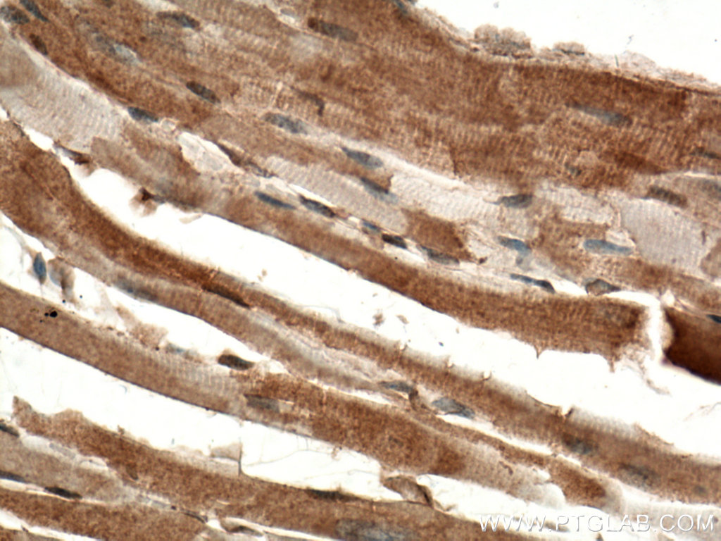 DAAM2 Polyclonal antibody