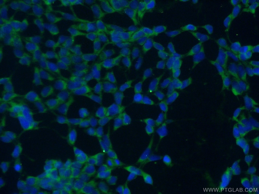 TXNDC9 Polyclonal antibody