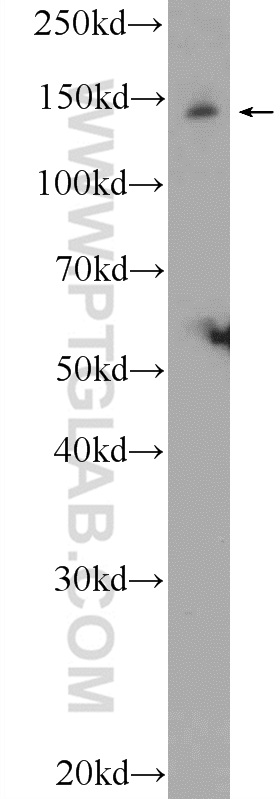 JIP3 Polyclonal antibody
