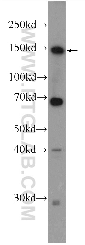 ZBTB11 Polyclonal antibody