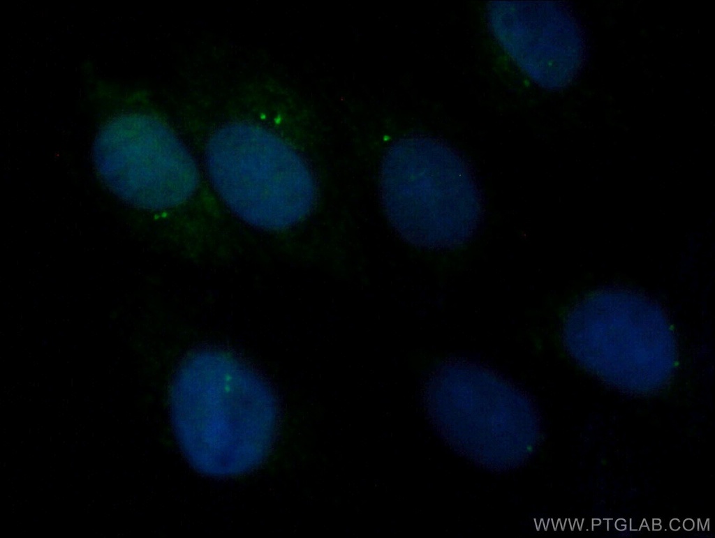 CEP110 Polyclonal antibody