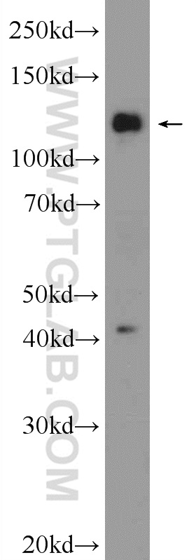 FNDC3A Polyclonal antibody