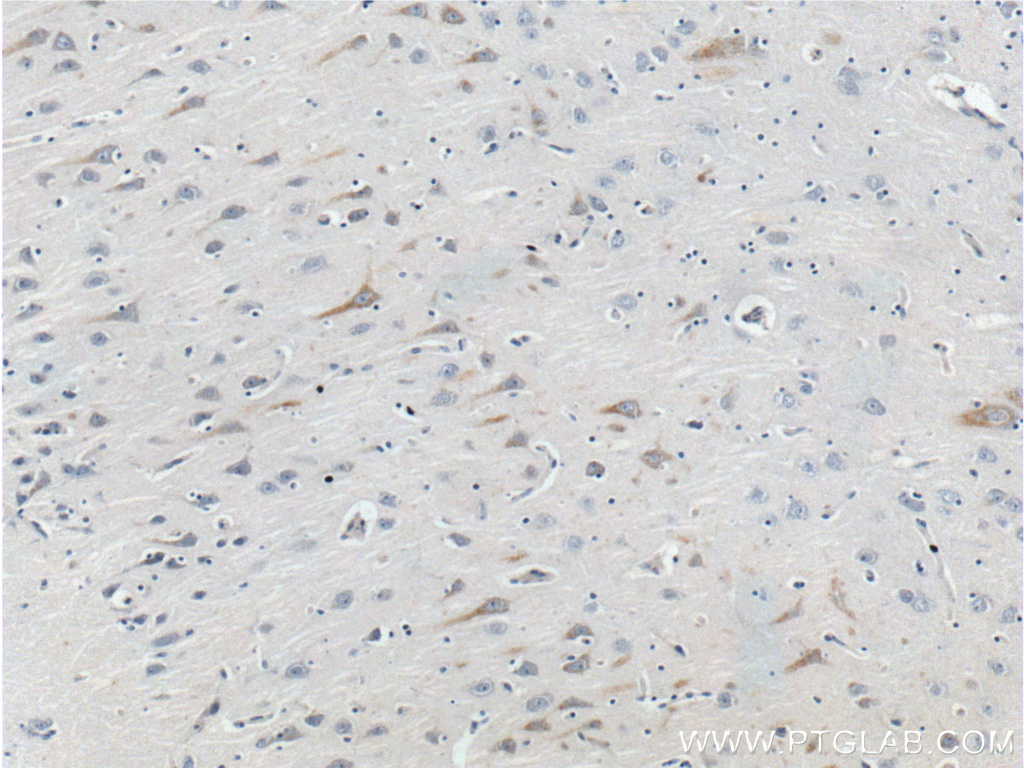 GPR103 Polyclonal antibody