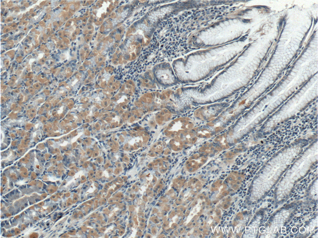 TBC1D24 Polyclonal antibody