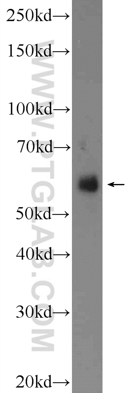 VGLUT2 Polyclonal antibody