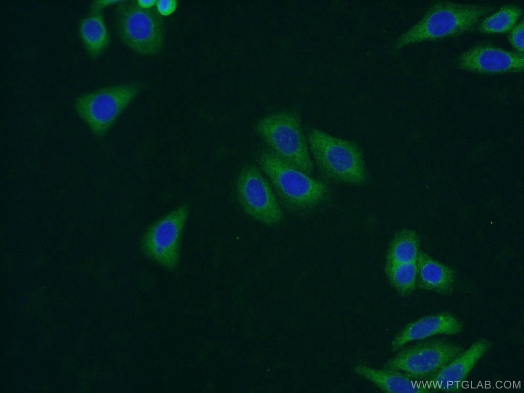 UAP1L1 Polyclonal antibody