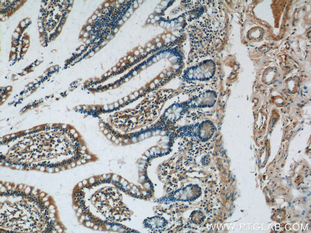 GPR44 Polyclonal antibody