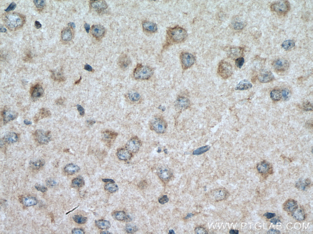 CRHR2 Polyclonal antibody
