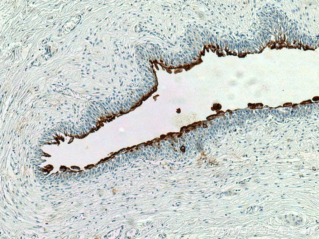 UPK1A Polyclonal antibody