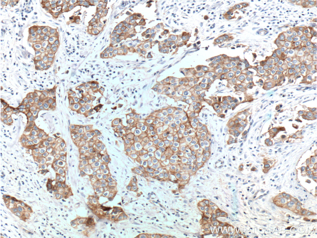 Integrin Beta 4 Polyclonal antibody