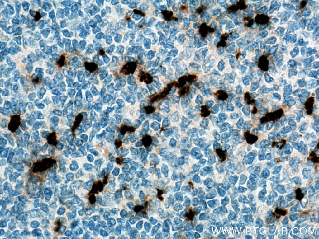 PRTN3 Polyclonal antibody